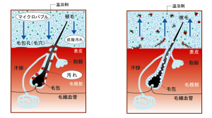マイクロバブルによる毛穴の洗浄イメージ